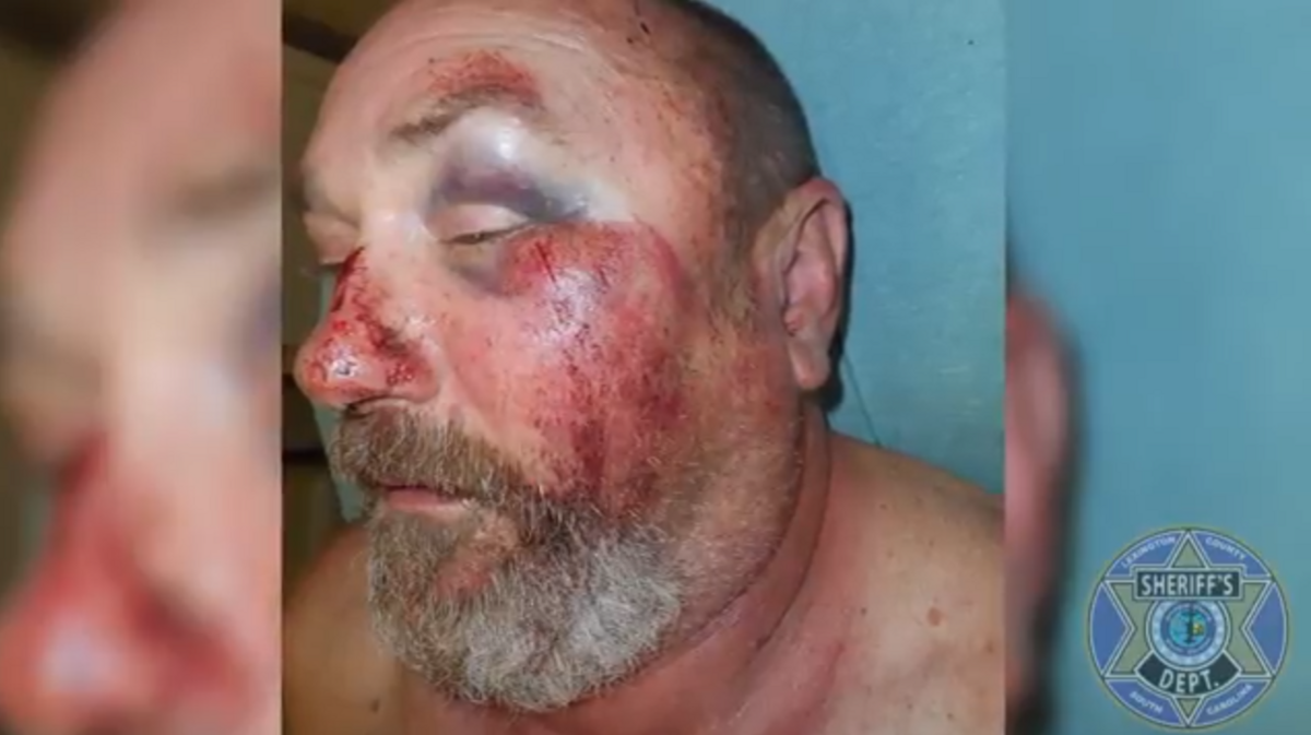 David Branham was beat to the point of hospitalization while trying to take his boat out of Lake Murray at Jake's Landing.
