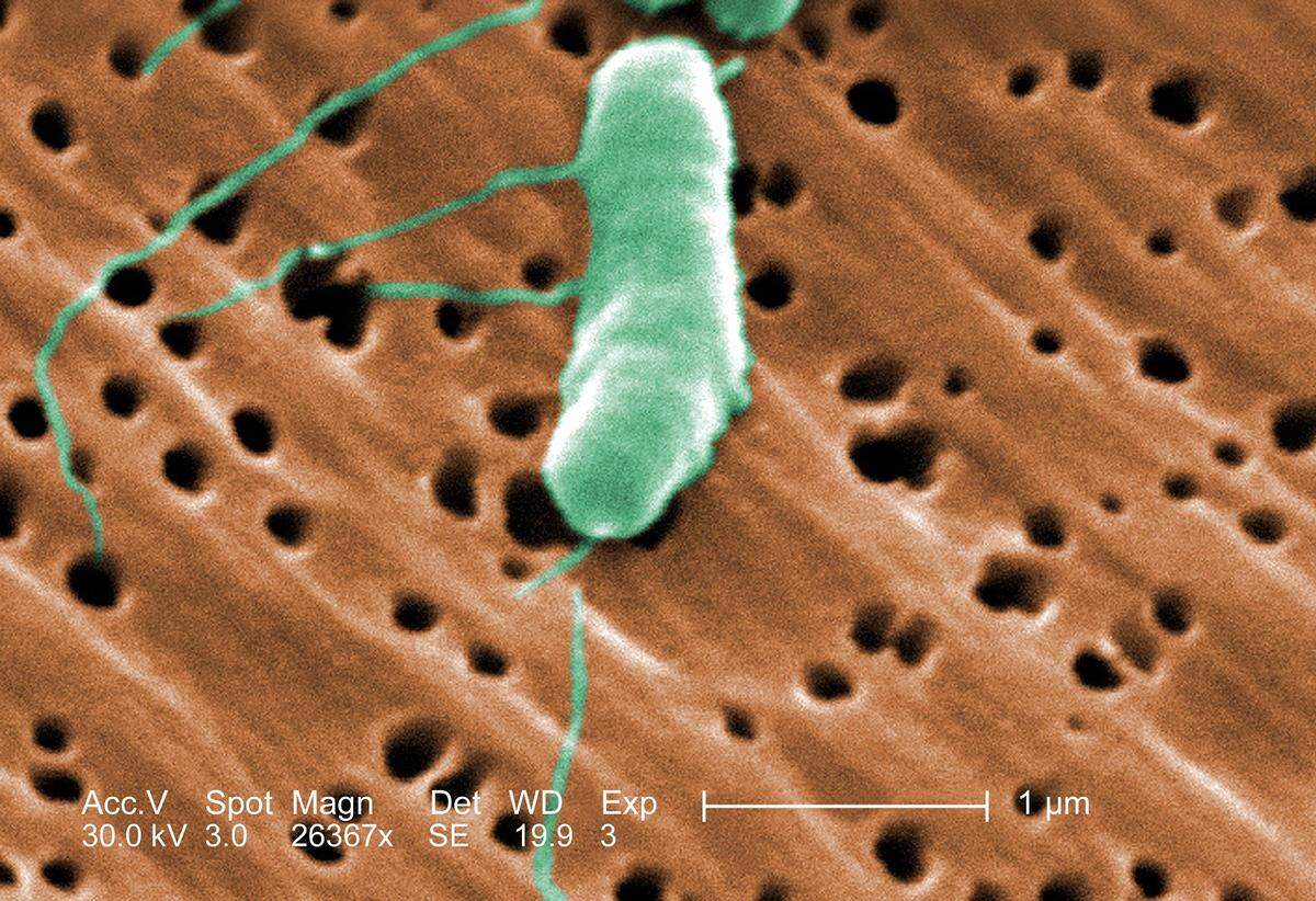 A flagellated vibrio vulnificus bacterium colorized on a scanning electron micrograph.