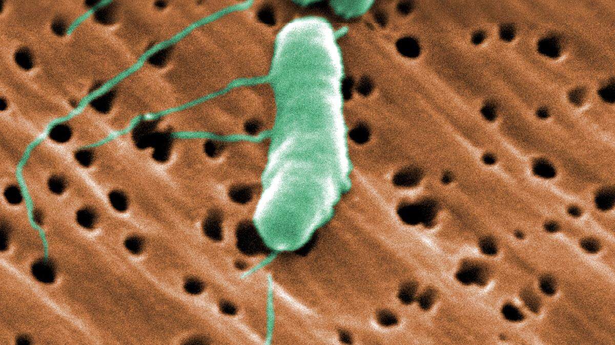 What is vibrio? Deadly flesh-eating bacteria migrates to odd place in Carolina waters