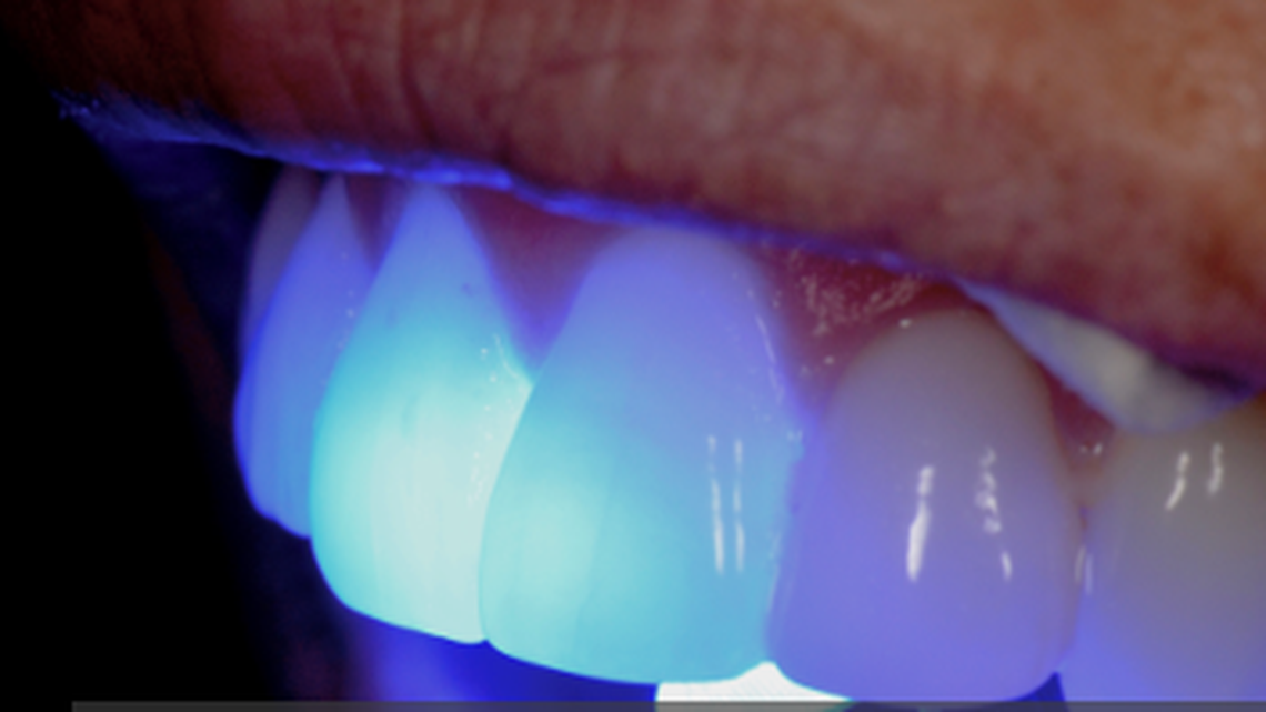 Fluoride is known for its dental benefits.