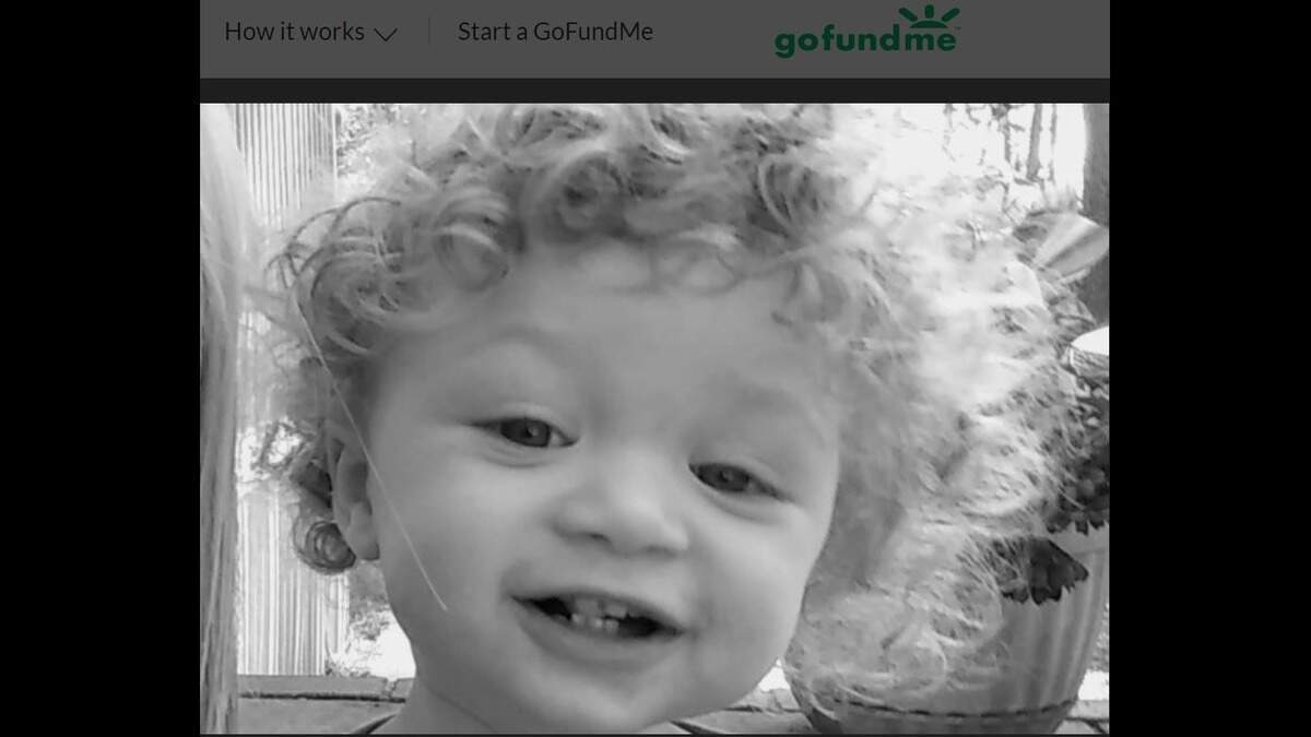 An online fundraiser has been started to help pay for the medical bills of the toddler severely burned in a car fire.