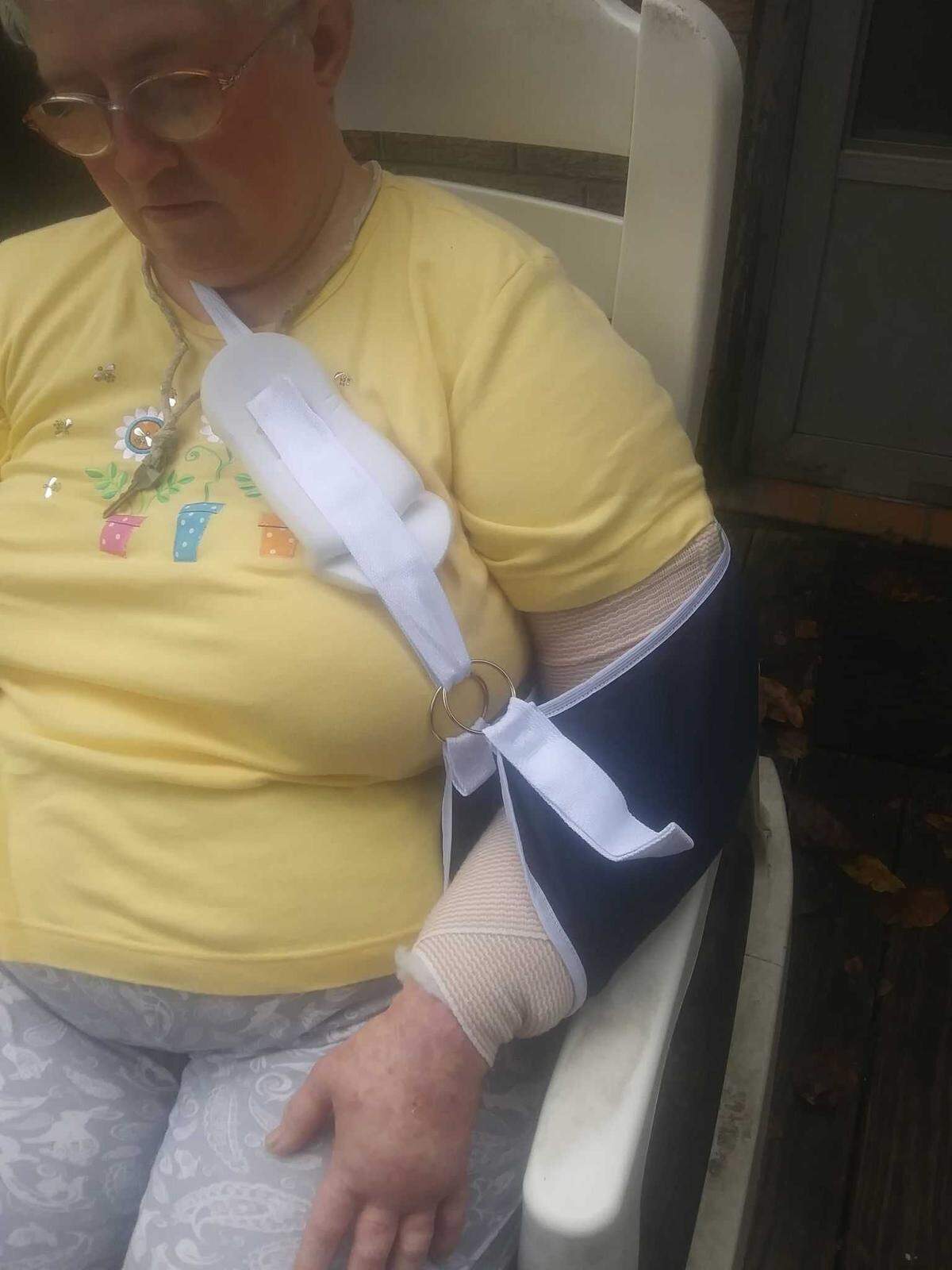 Donna Roland broke her arm in two places after tripping and falling in front of the Lexington County Auxiliary Administration building.
