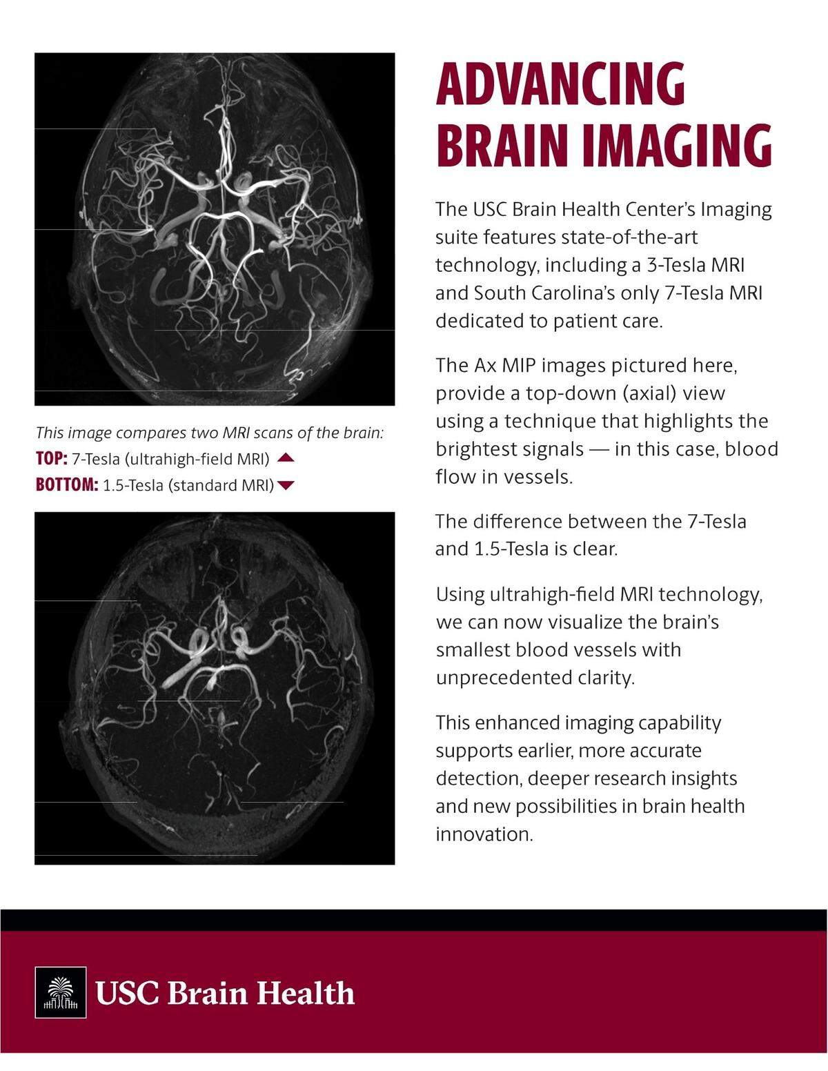 USC’s Brain Health Center, expected to open next month in downtown Columbia, will house the most powerful MRI scanner in the state.