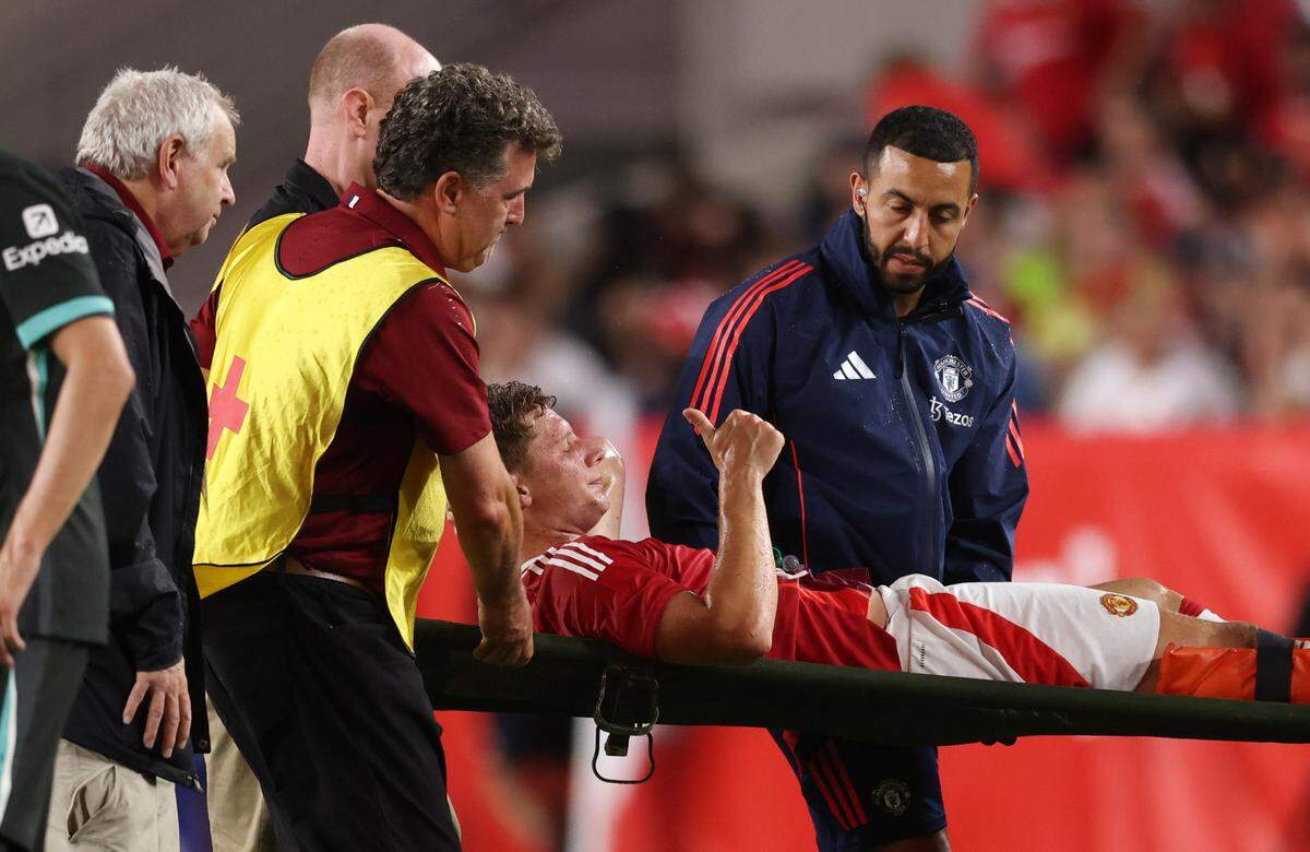 Manchester United’s Will Fish is taken out on a stretcher after being injured during the Rivals in Red International Friendly soccer match between Manchester United and Liverpool in Columbia on Saturday, August 3, 2024.