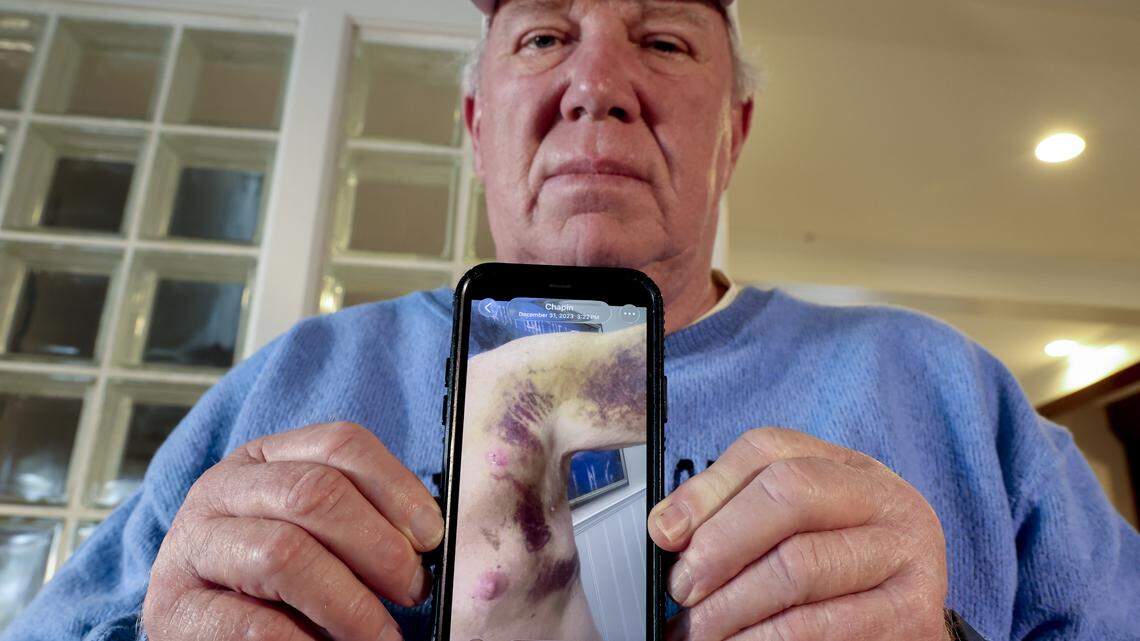 Man found not guilty after stabbing his neighbor. Could he be released soon?