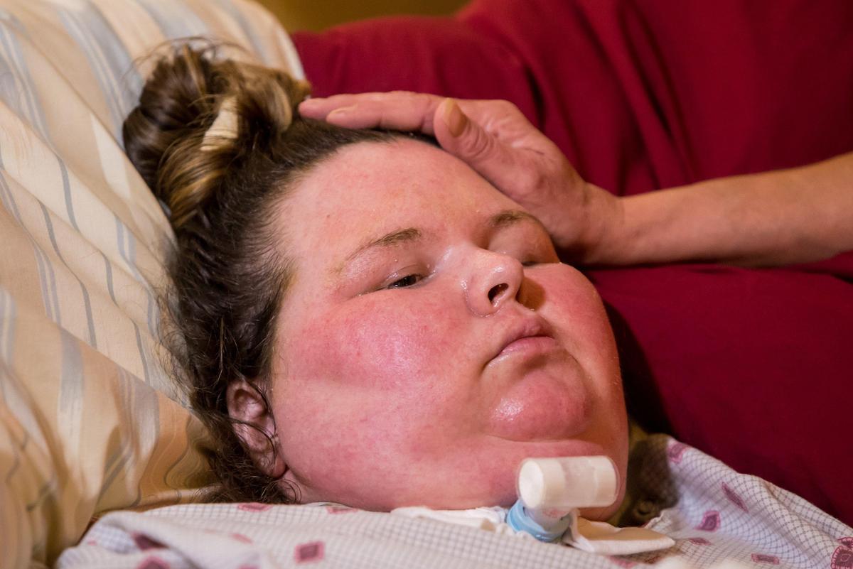 Jodie Roberts’ caretaker, Michelle Stevenson, strokes Roberts’ face. Roberts is in a vegetative state after being without oxygen for roughly twenty minutes while giving birth to her son in July 2018.