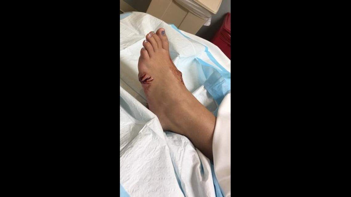 Erica Hedrick had to get 29 stitches after the attack, her family said. 