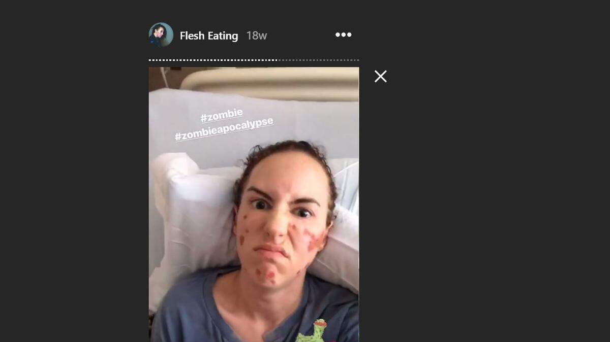 Doctors put Rachel Star Withers in isolation as they treated the aggressive bacteria.