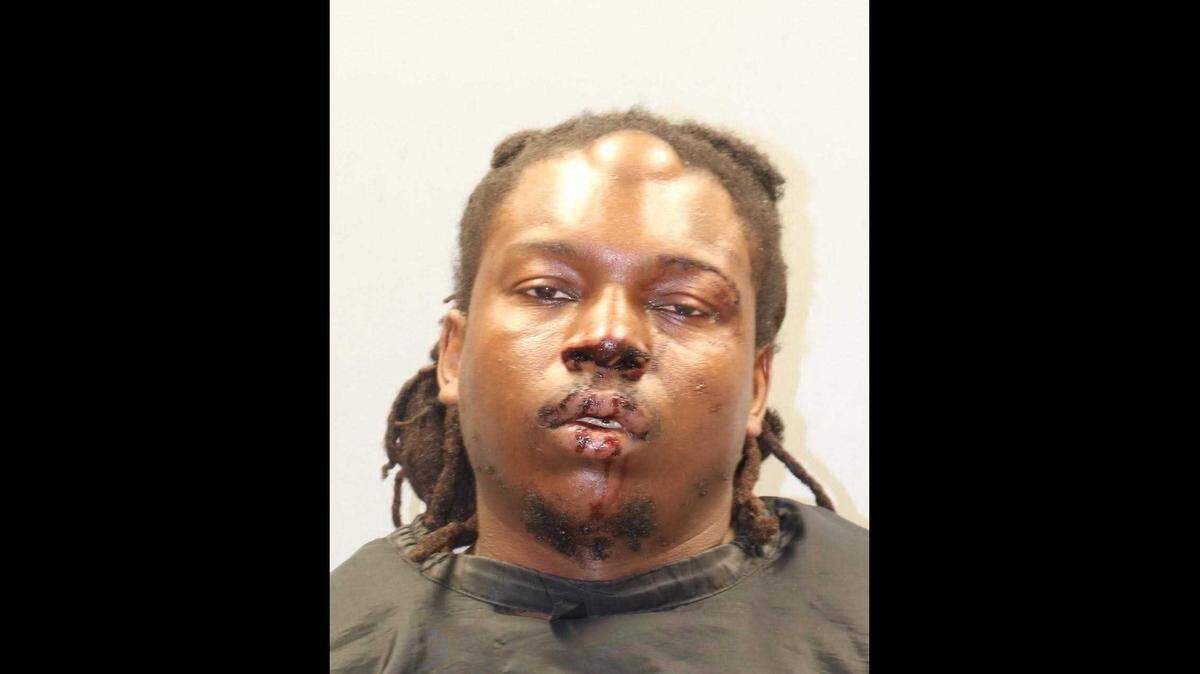 Maxie Outen, 31, sustained multiple injuries to his face following a traffic stop by the Richland County Sheriff’s Department on Dec. 6, 2025.