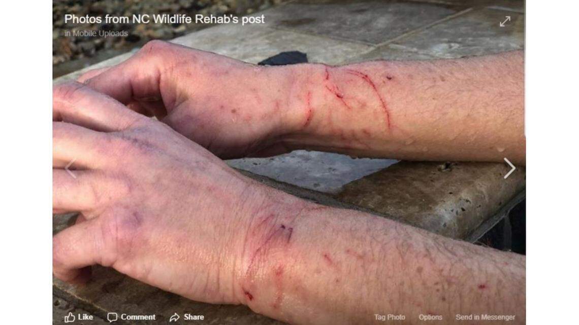 This screenshot shows the scars a squirrel left on an employee at NC Wildlife Rehab.
