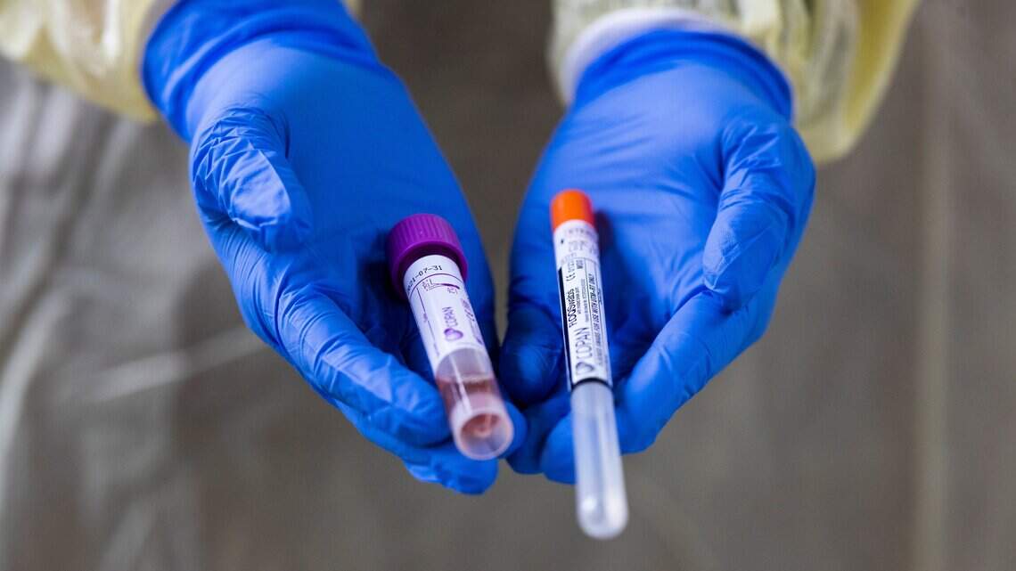 More of drug touted to help COVID-19 patients is available in South Carolina