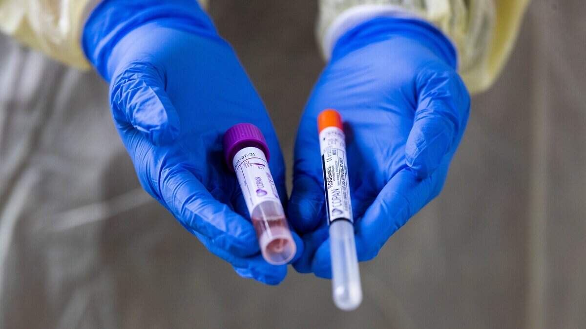 A nurse shows a test for the coronavirus at the Kershaw Mental Health Clinic in Camden, South Carolina on Monday, March 23, 2020. Those who want to be tested should call 877-529-4339 to schedule an appointment. It can take four days to process.