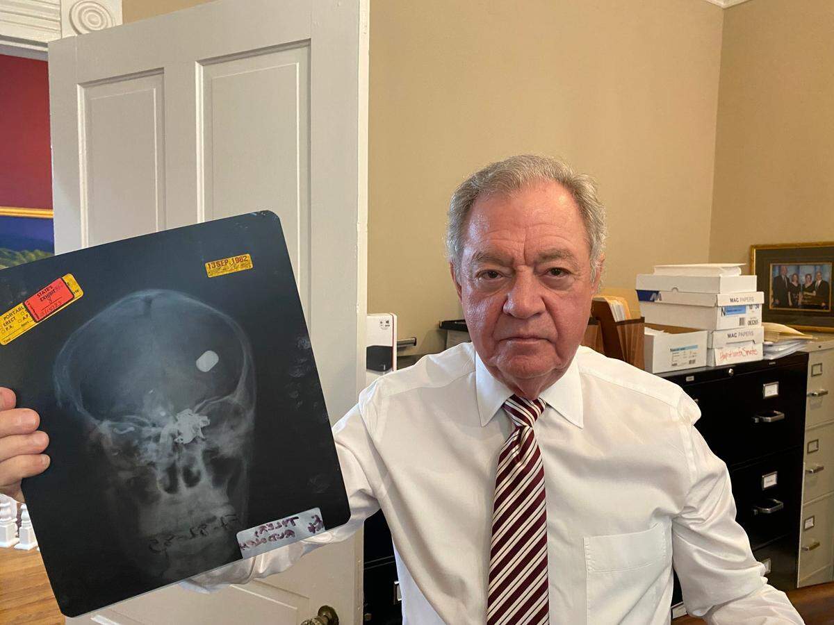 Dick Harpootlian, attorney and author of “Dig Me a Grave,” holds up an X-ray of the skull of Rudolph Tyner with the shrapnel that killed him in the Death Row explosion clearly visible.