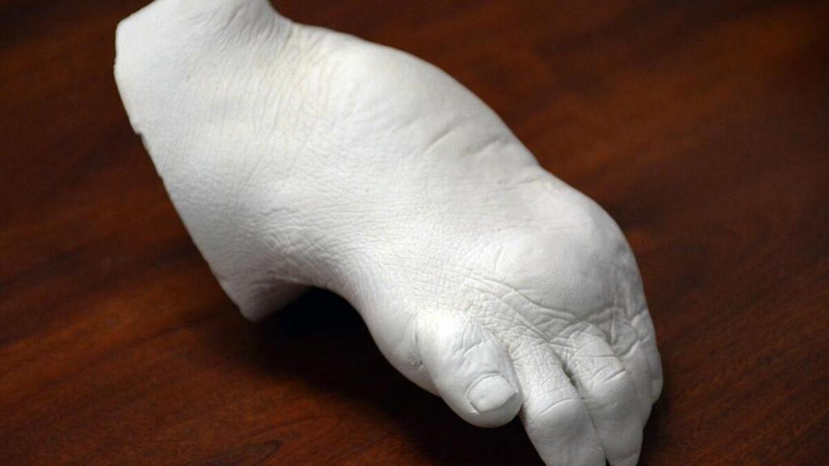 The mold of Sonn’s foot