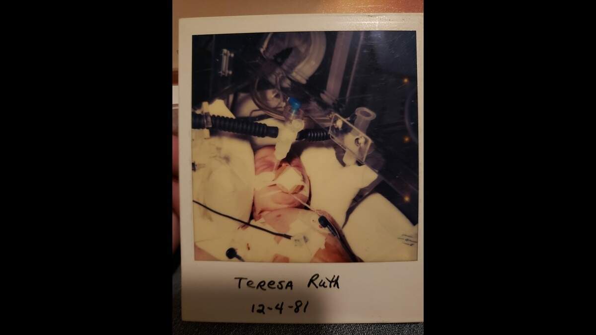 A Polaroid photo showing Teresa Dawley, a day after she was airlifted to Richland Memorial Hospital in Columbia from a Lancaster hospital.