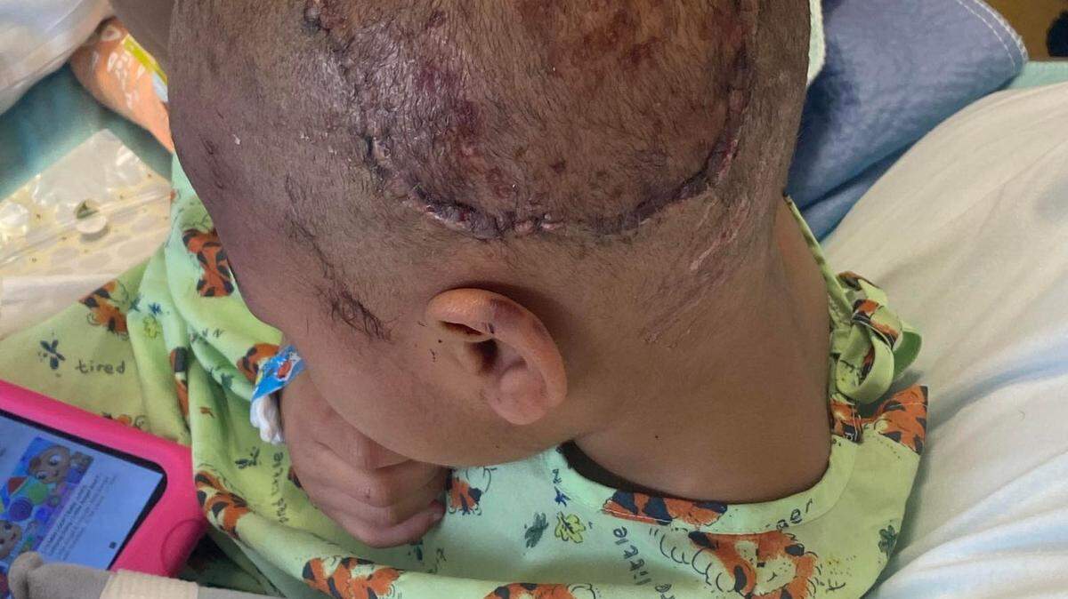 Three-year-old Kaliyah Nipper was attacked by dogs Feb. 14 in a Columbia neighborhood. Her mother wants the dogs euthanized.