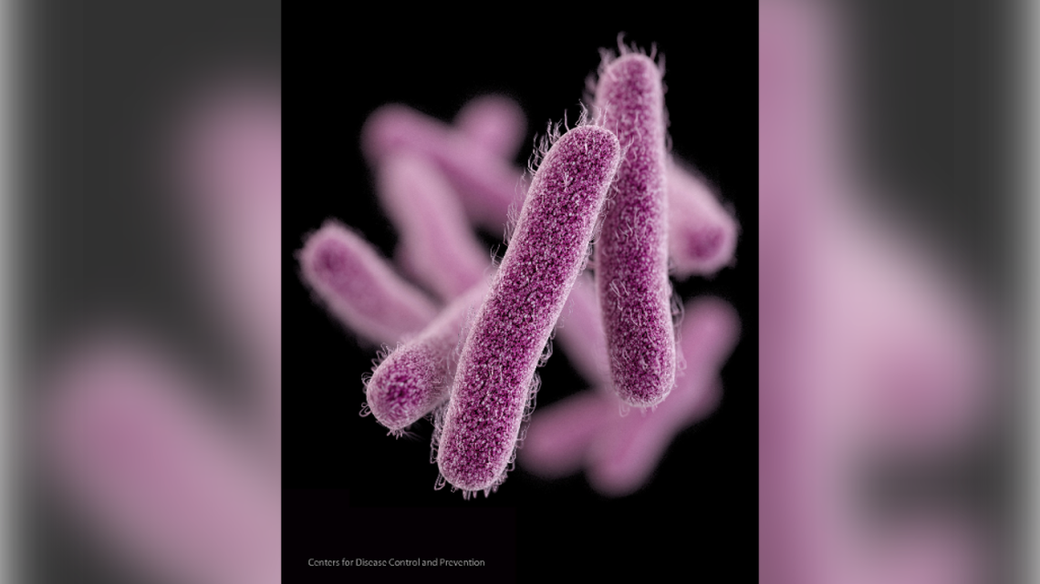 File photo. This illustration made available by the Centers for Disease Control and Prevention shows the Shigella bacteria. On Thursday, April 2, 2015, the CDC said a drug-resistant strain of a stomach bug made its way into the U.S. and spread, causing more than 200 illnesses since last May. Many cases were traced to people who had recently traveled to the Dominican Republic, India or other countries.