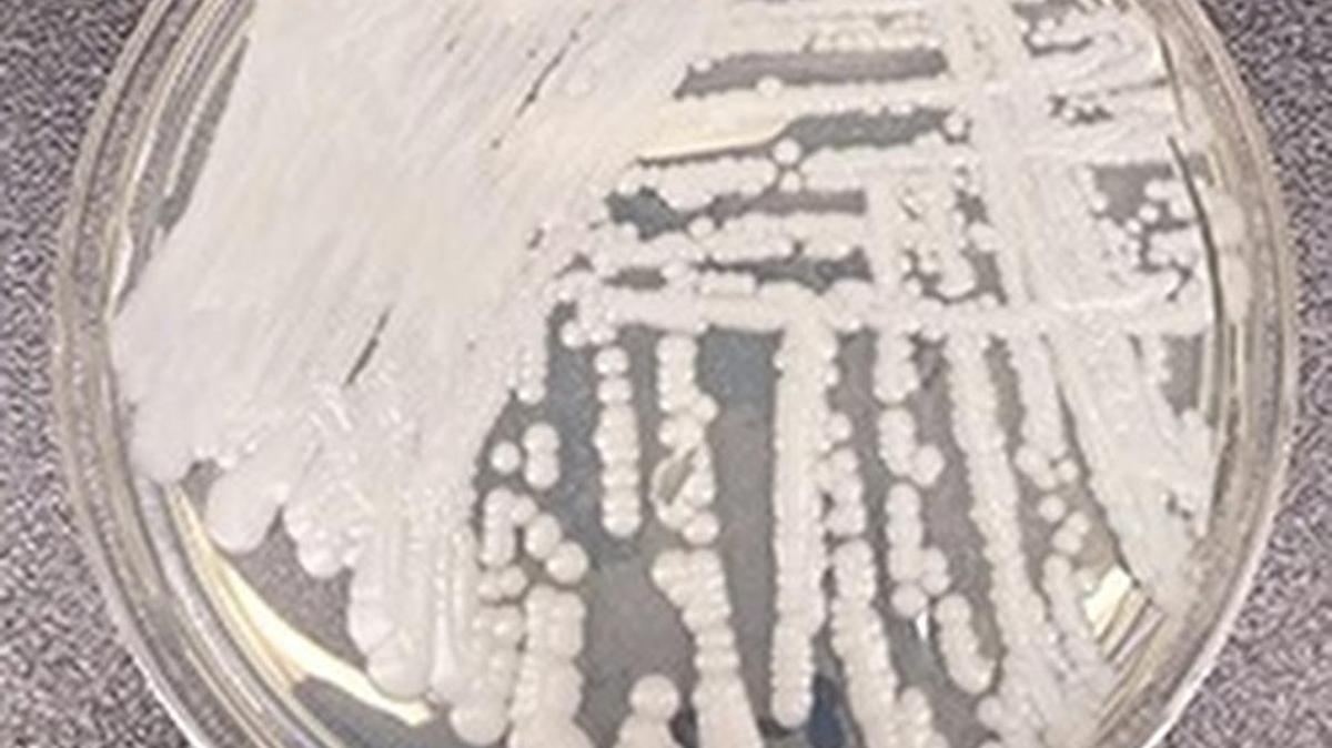 A strain of Candida auris cultured in a petri dish at the Centers for Disease Control and Prevention.