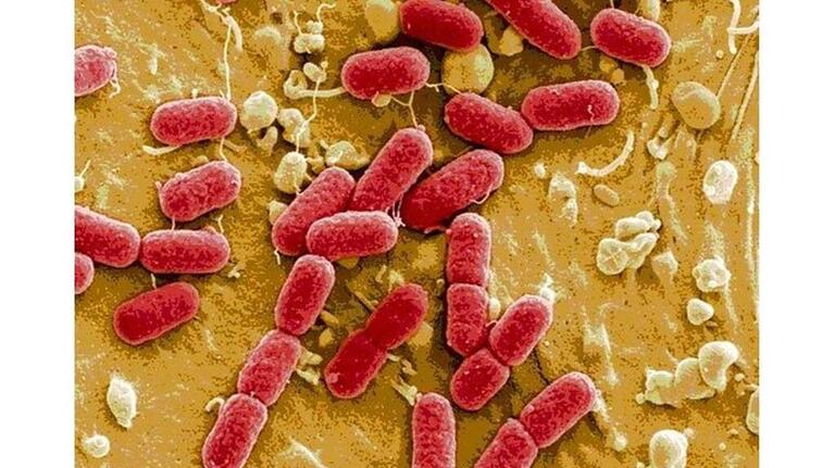 E. coli outbreak linked to SLO County farm grows. 6 things to know