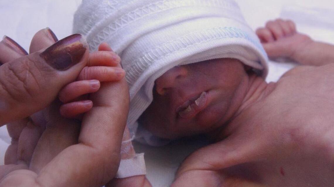 Infant survival improved in North Carolina, but black babies are more likely to die